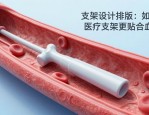 支架设计排版：如何让医疗支架更贴合血管？
