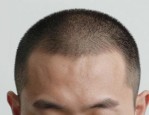 男士短发两边铲后面怎么剪及不同脸型发型选择与碎短发造型